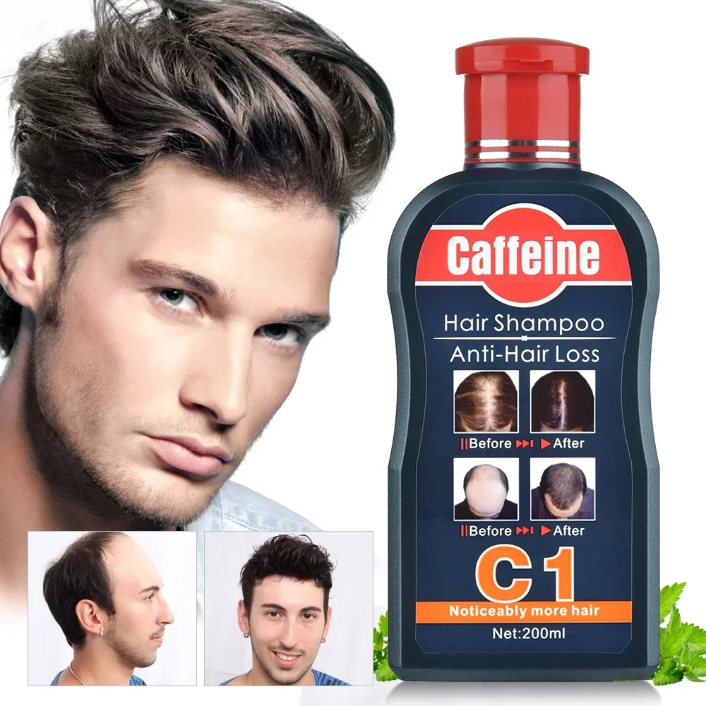 Hair Care Korean Products - 남성용 모발 성장 천연 식물 샴푸,