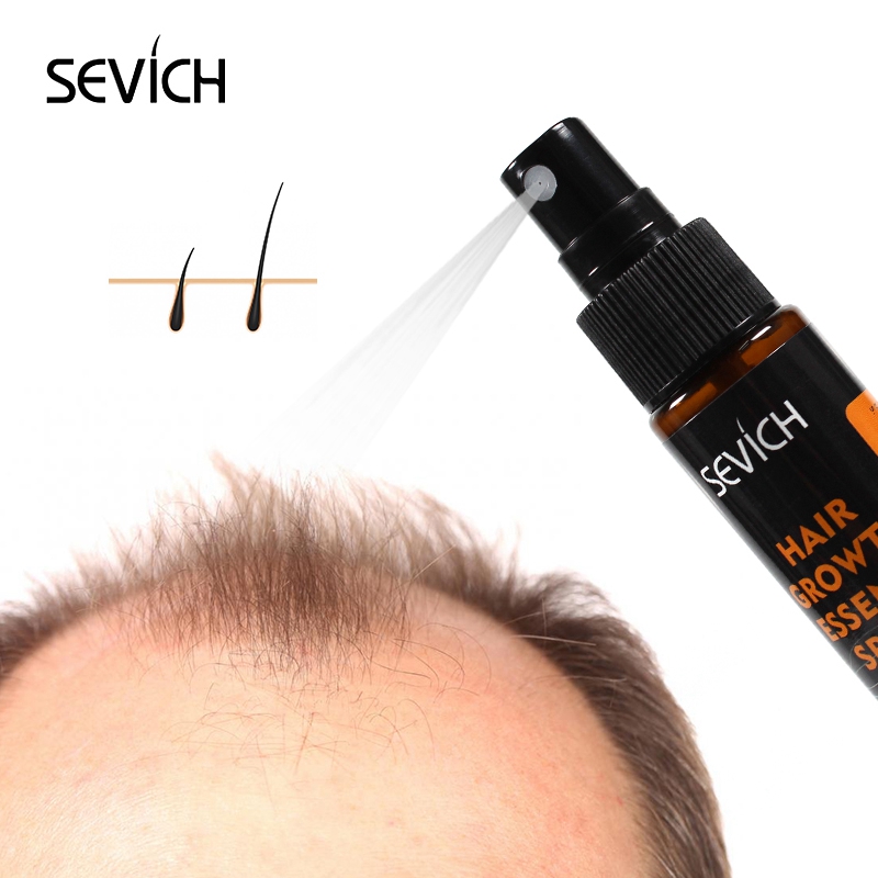 Sevich 헤벌 오일 에센스, 빠른 모발 성장 스프레 - Hair Care Frizzy Hair 리뷰 및 가격