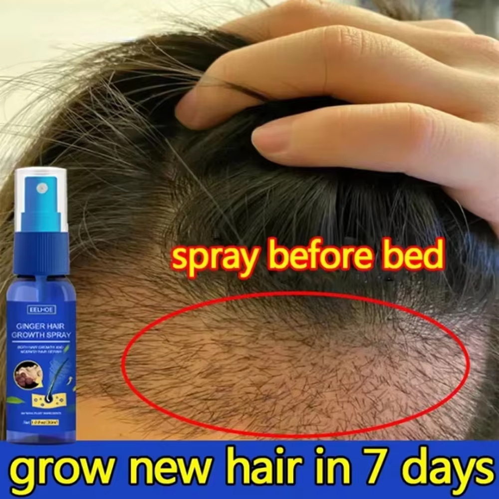 빠른 생강 모발 성장 스프레이, 모발 뿌리 강화, 탈모 - Hair Care Frizzy Hair 리뷰 및 가격