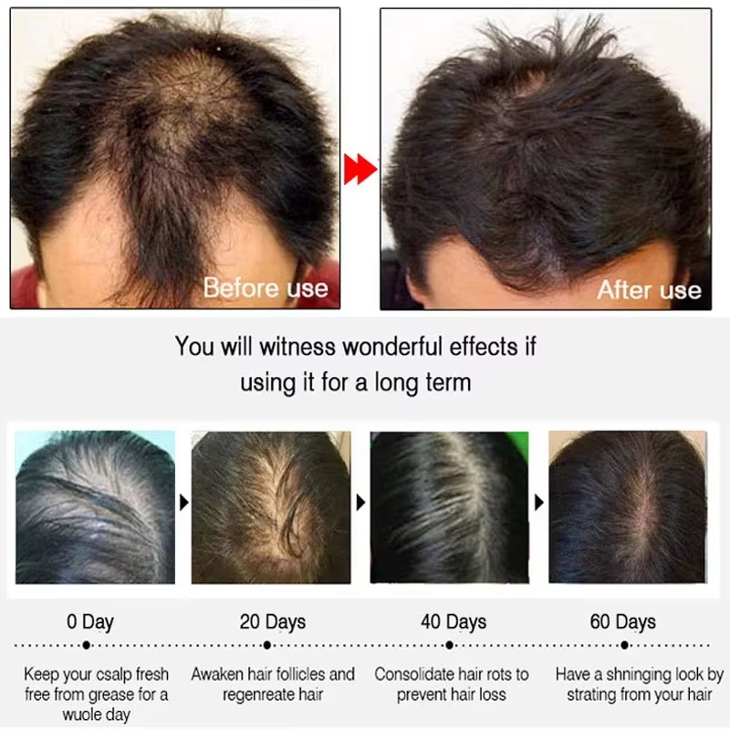 빠른 생강 모발 성장 스프레이, 모발 뿌리 강화, 탈모 - Hair Care Frizzy Hair 리뷰 및 가격